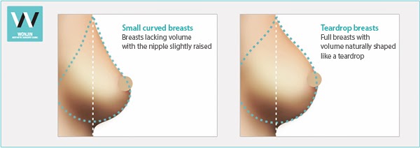 Naked Small Breast Variety 14